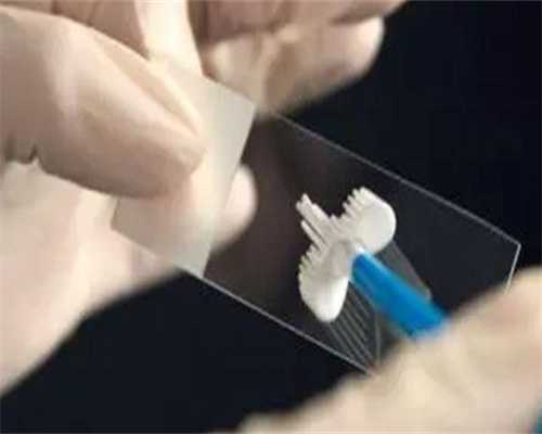 代孕网哪家正规_靠谱的代孕机构电话,供卵移植双囊胚,供卵移植一个囊胚