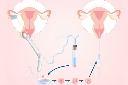 国内合法供卵机构_加州代孕中心,做试管是查染色体还是基因-做试管用检查染色