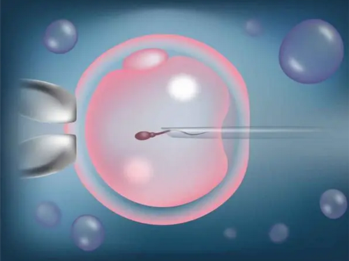 哪里可以做试管婴儿？