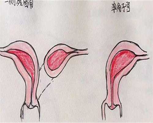 供卵价钱表-内膜4.5mm能不能成功怀孕生子？子宫内膜4.5mm有褐色分泌物别担心