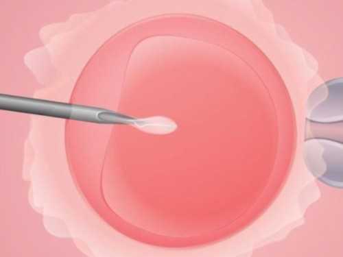 经期不规律是病吗？六大原因致例假推迟