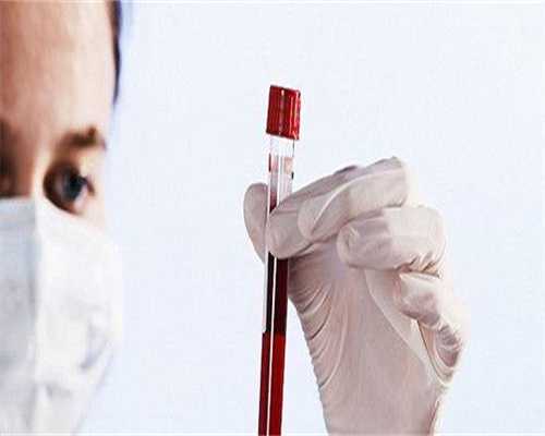 我想找个代孕,
              孕初期不能碰的18种活血食物有哪些？
