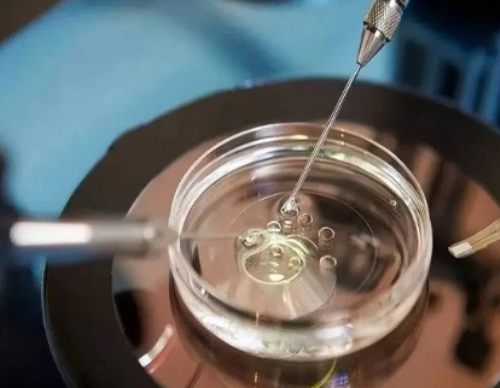 供卵生子医院-子宫肌瘤12×8mm严重吗