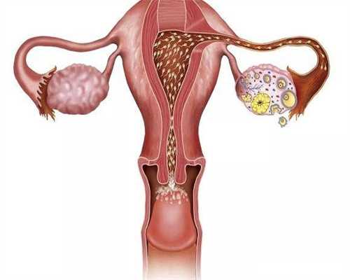 四川做泰国试管婴儿备孕期间不能吃什么？